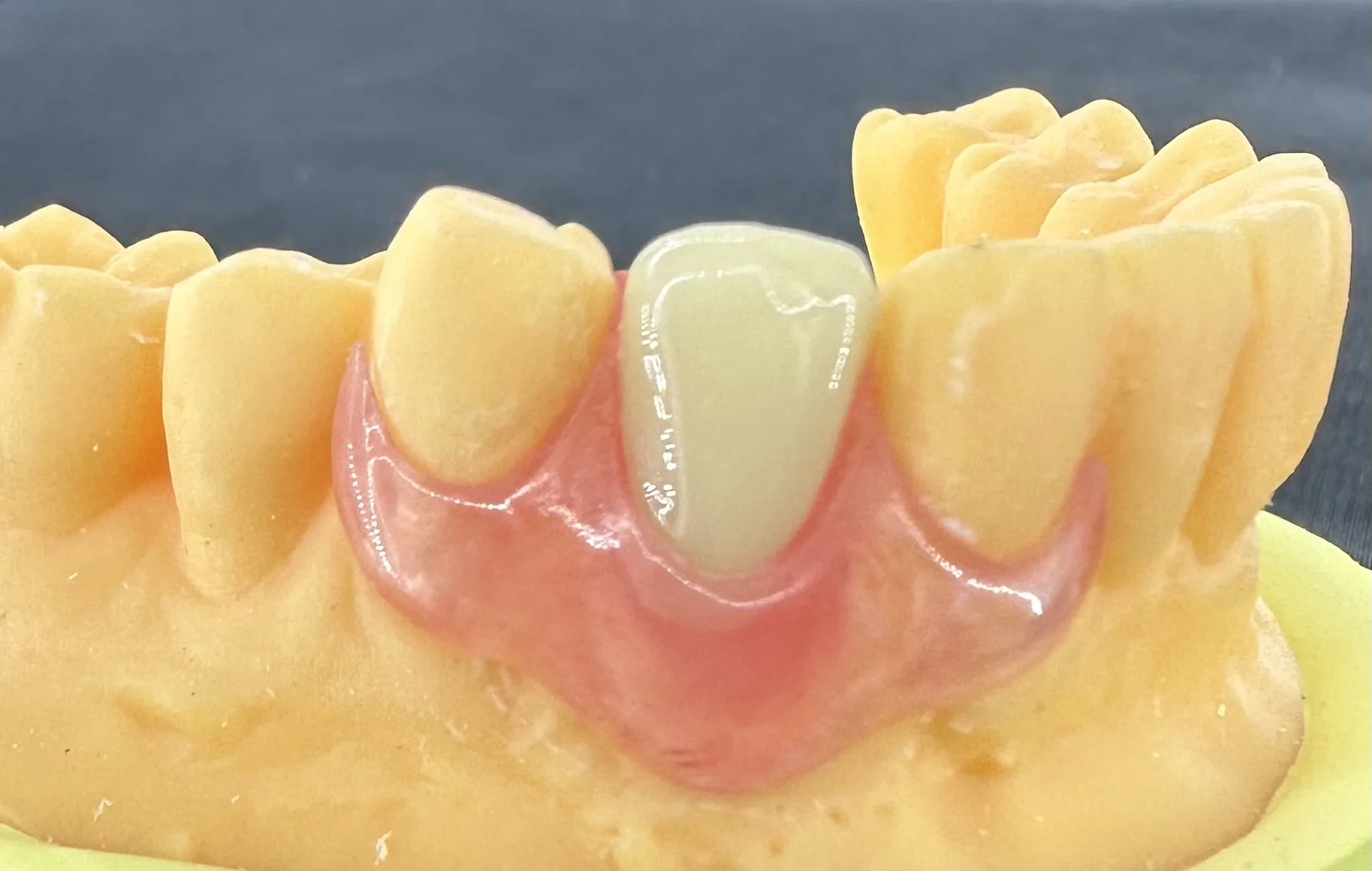 Résine Flexible Biosoft
