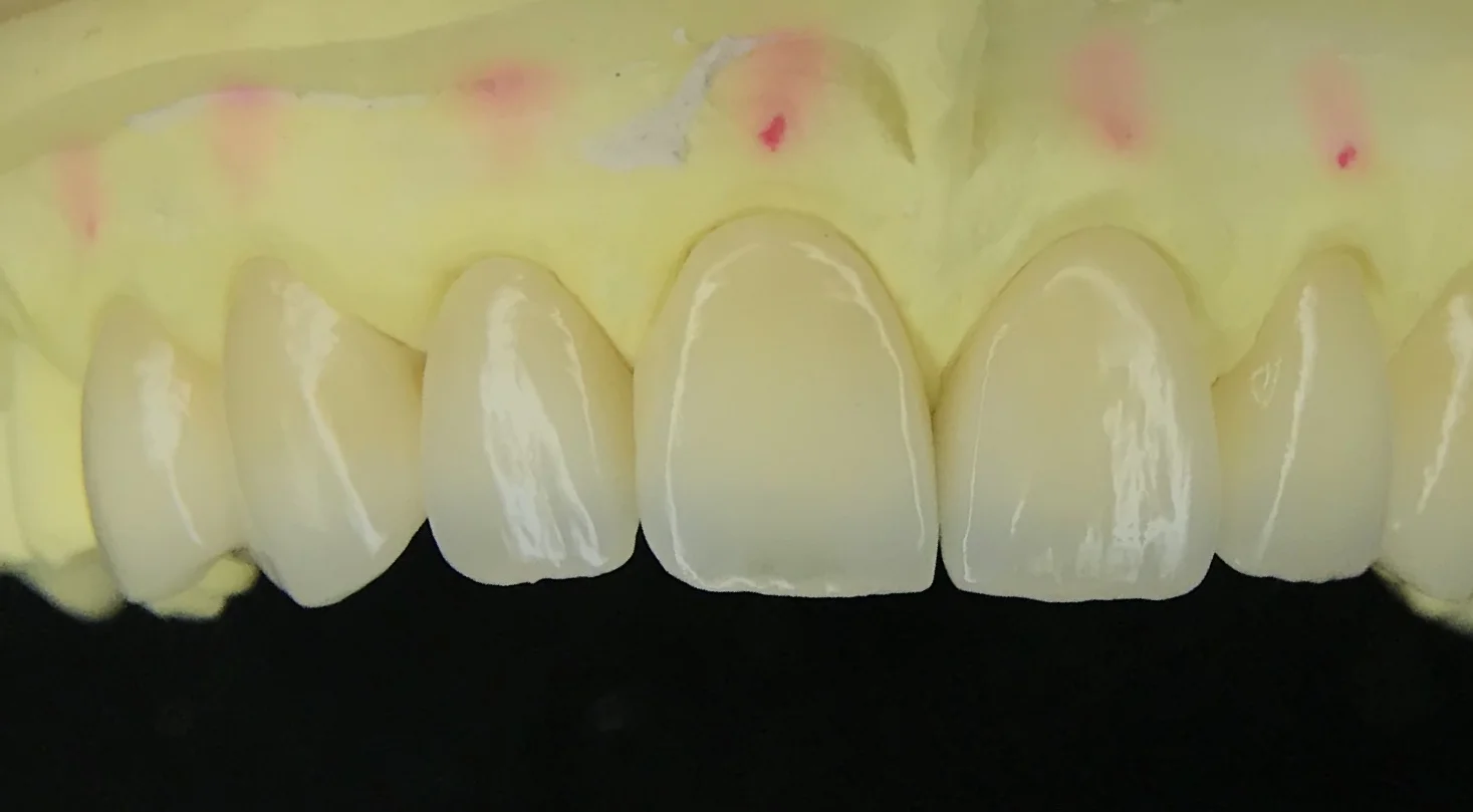 Advanced dental equipment and treatment setup