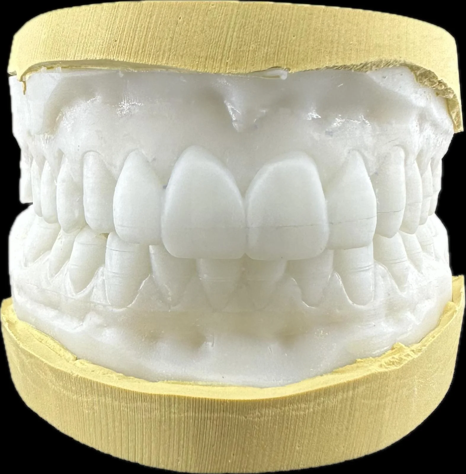 Diagnostic WAX-UP